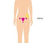 卵巣・・ガン？